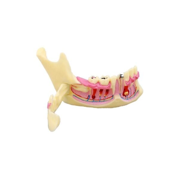 iDENTical Mandible Bone Model M4014